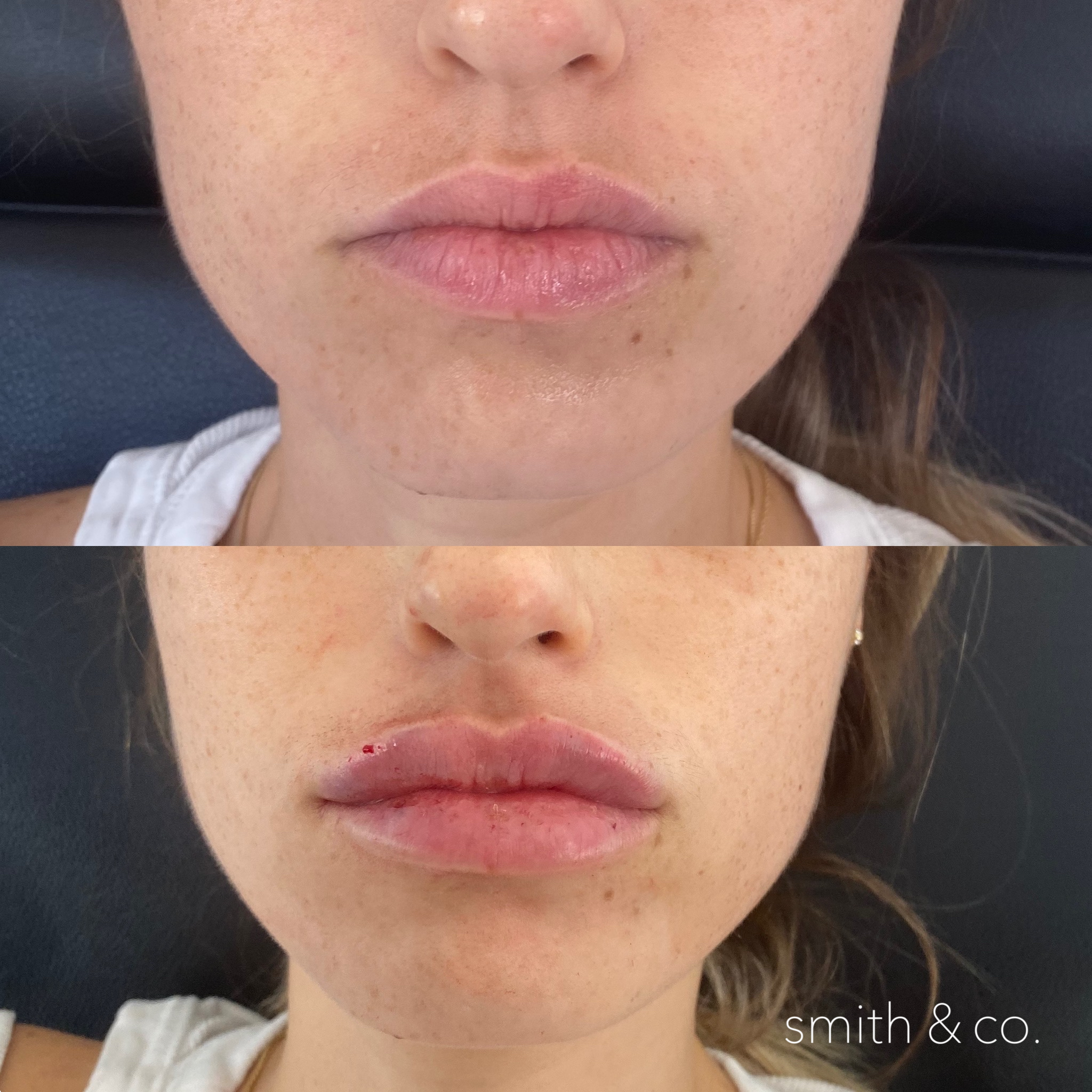 smith & co best botox and filler in miami_2176.PNG