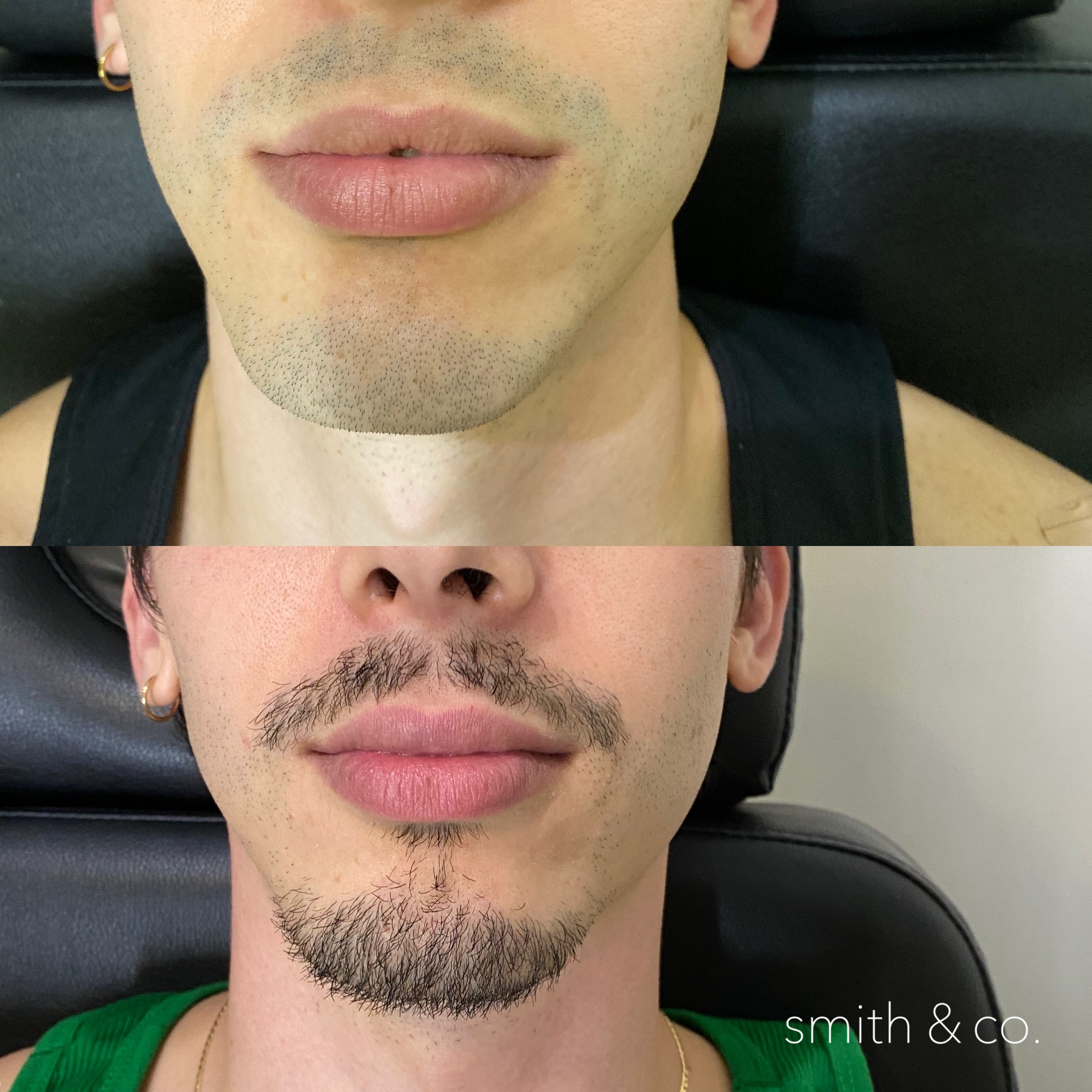 smith & co best botox and filler in miami_2612.PNG