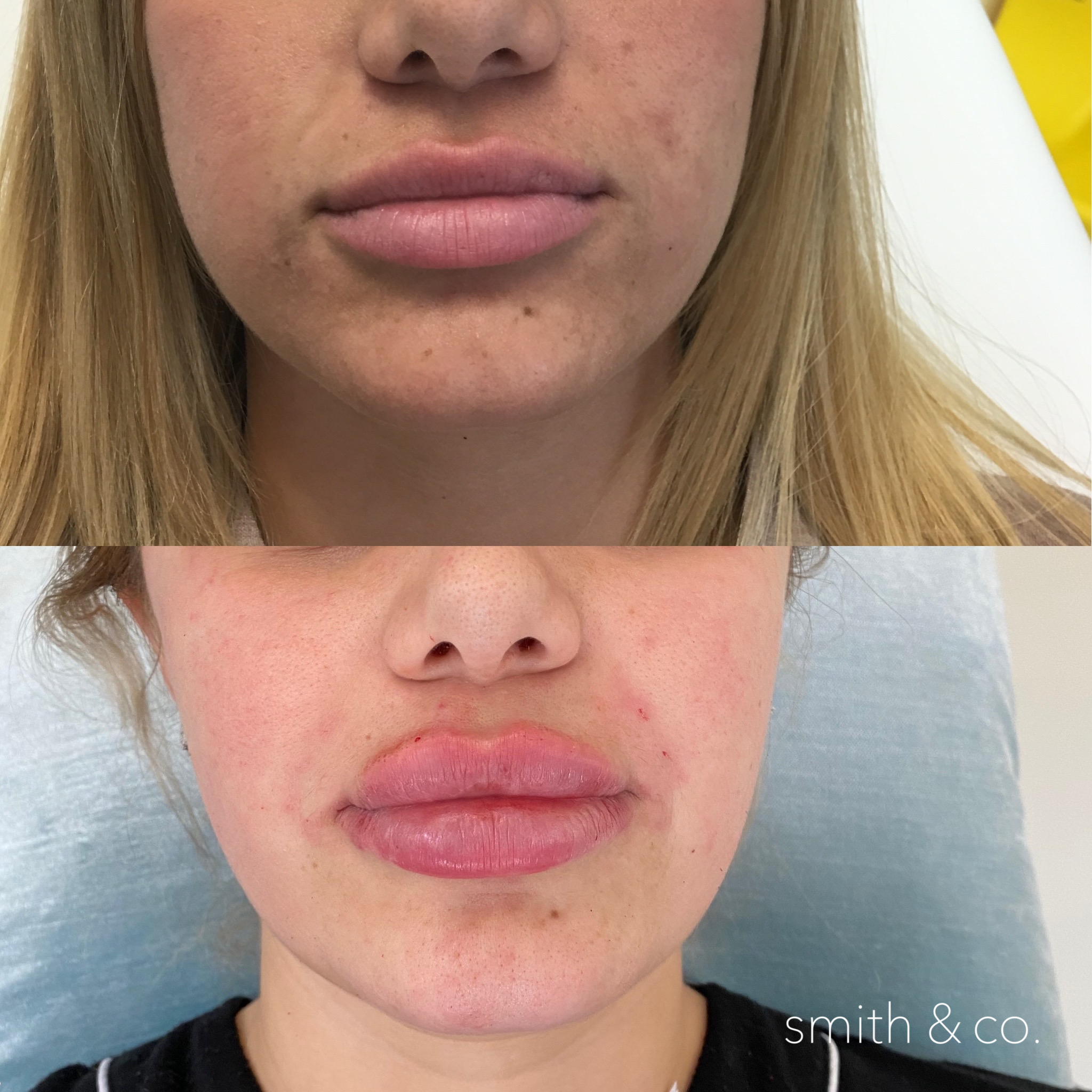 smith & co best botox and filler in miami_2622.PNG