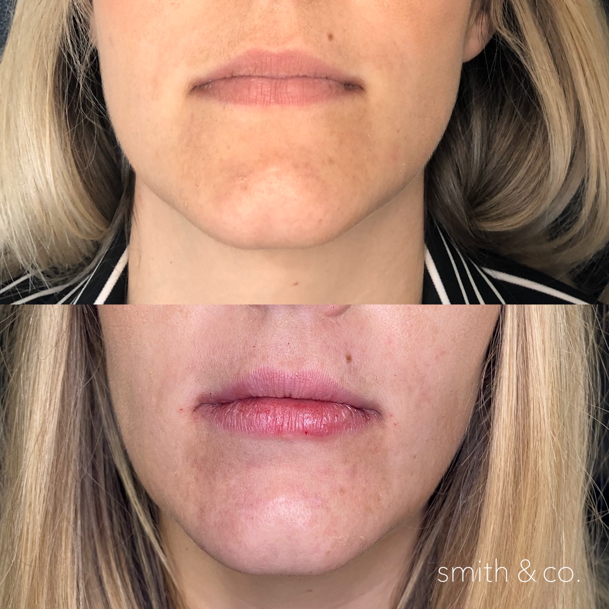 smith & co best botox and filler in miami_2620.PNG