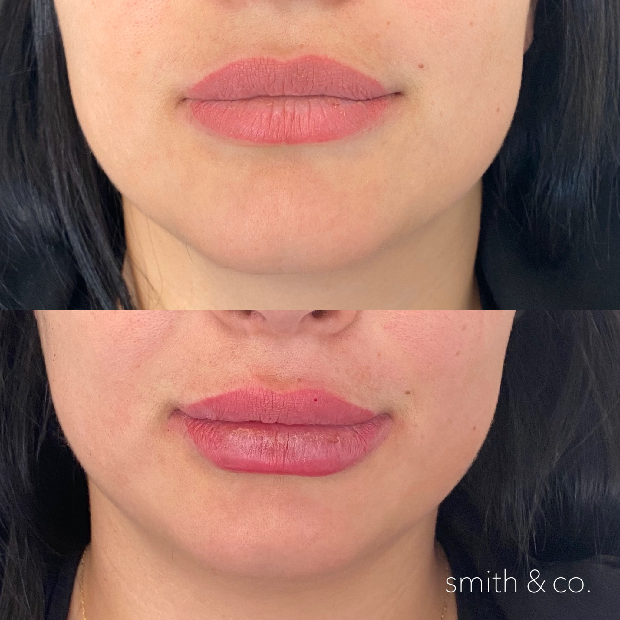 smith & co best botox and filler in miami_2680.PNG