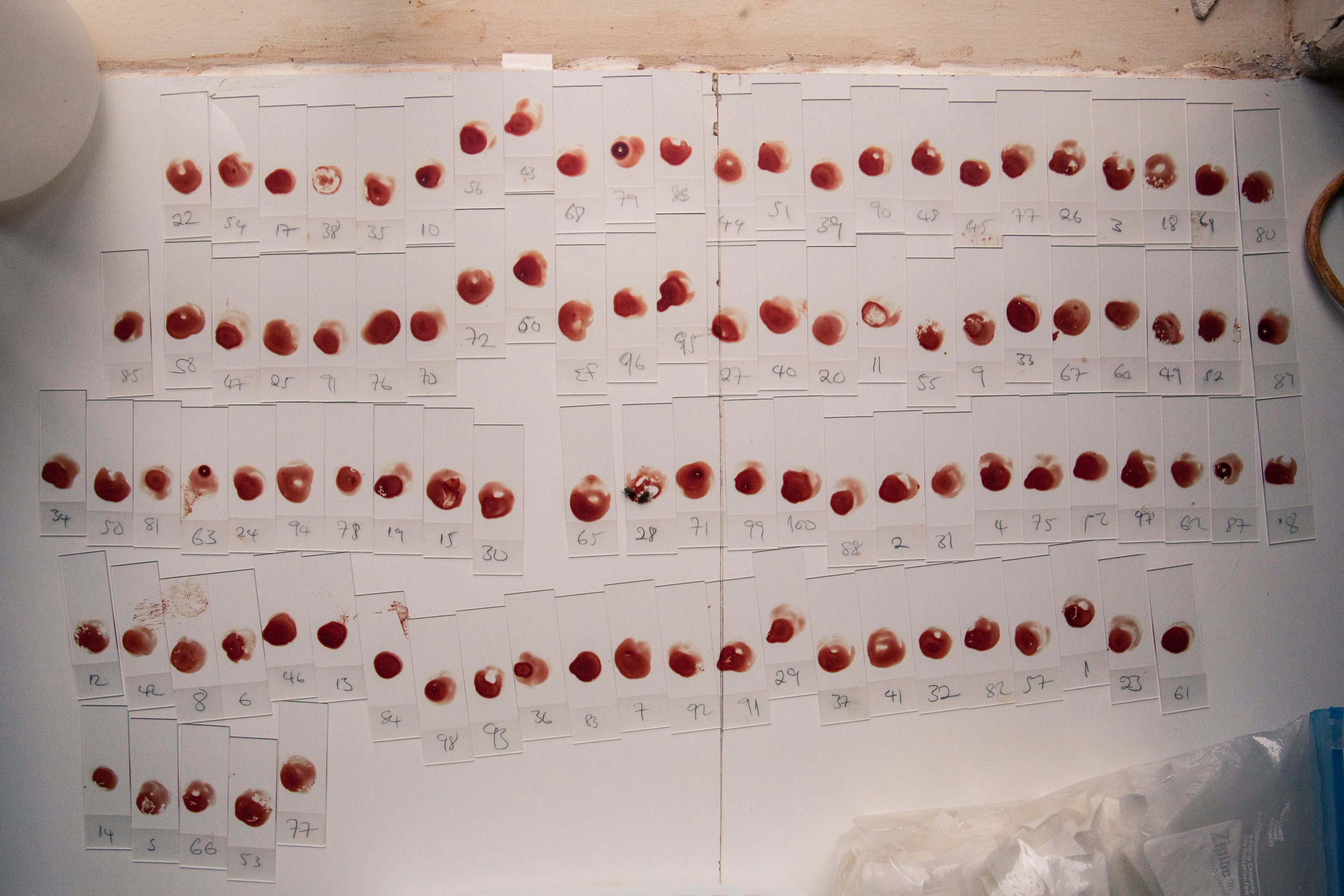 Malaria smears ready to be tested.
