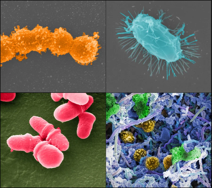 The Difference Between Prebiotics And Probiotics