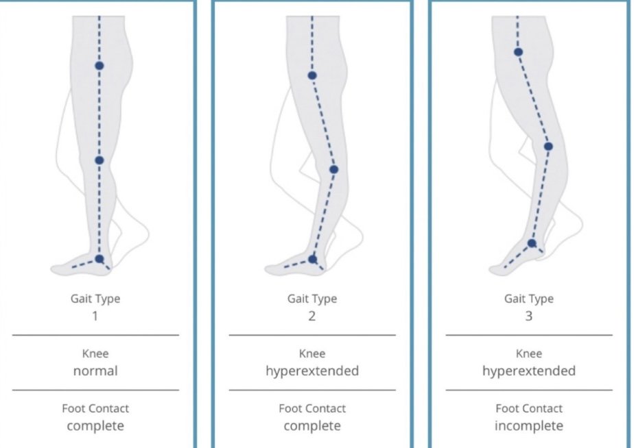 Banana Knee: Hypermobility Leading to Dysfunction and Vice Versa — BE