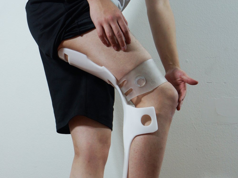 Harry Teng develops shower-proof Lytra prosthesis for amputees