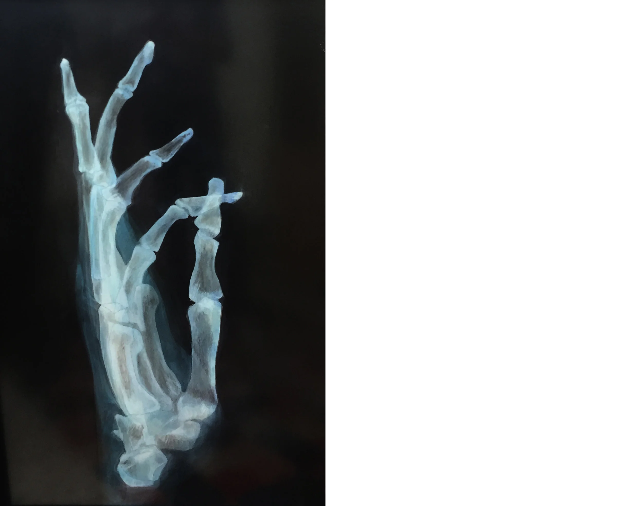 Ed Aulerich-Sugai, Xray series, 1980. Acrylic. 45 x 30 inches.