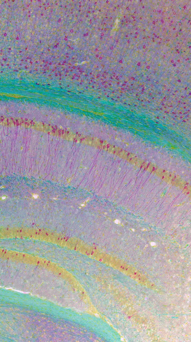 inverted hippocampus