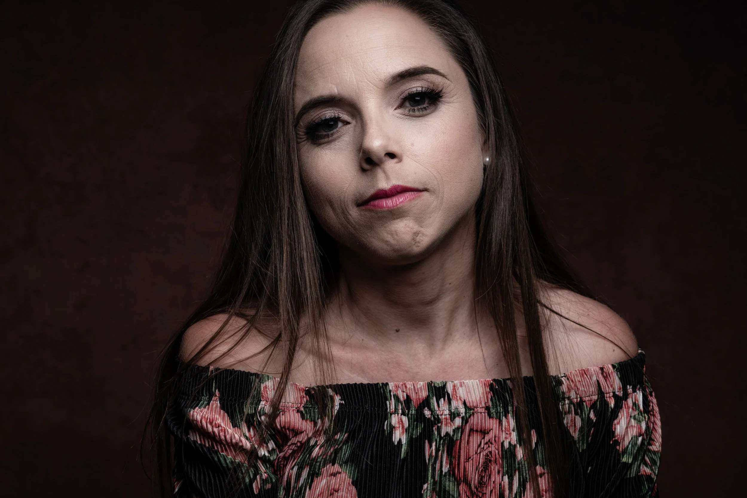 Laura "Anorexia Misdiagnosed"