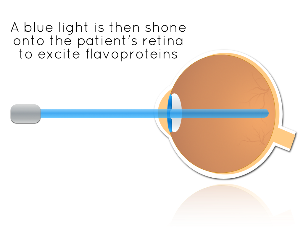 eye diagram new 2.png