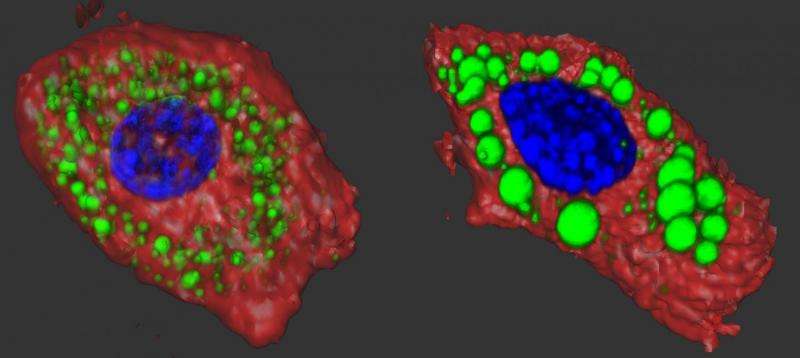 The R1788W ankyrin-B mutation causes enlarged fat droplets to form. Credit: Damaris Lorenzo