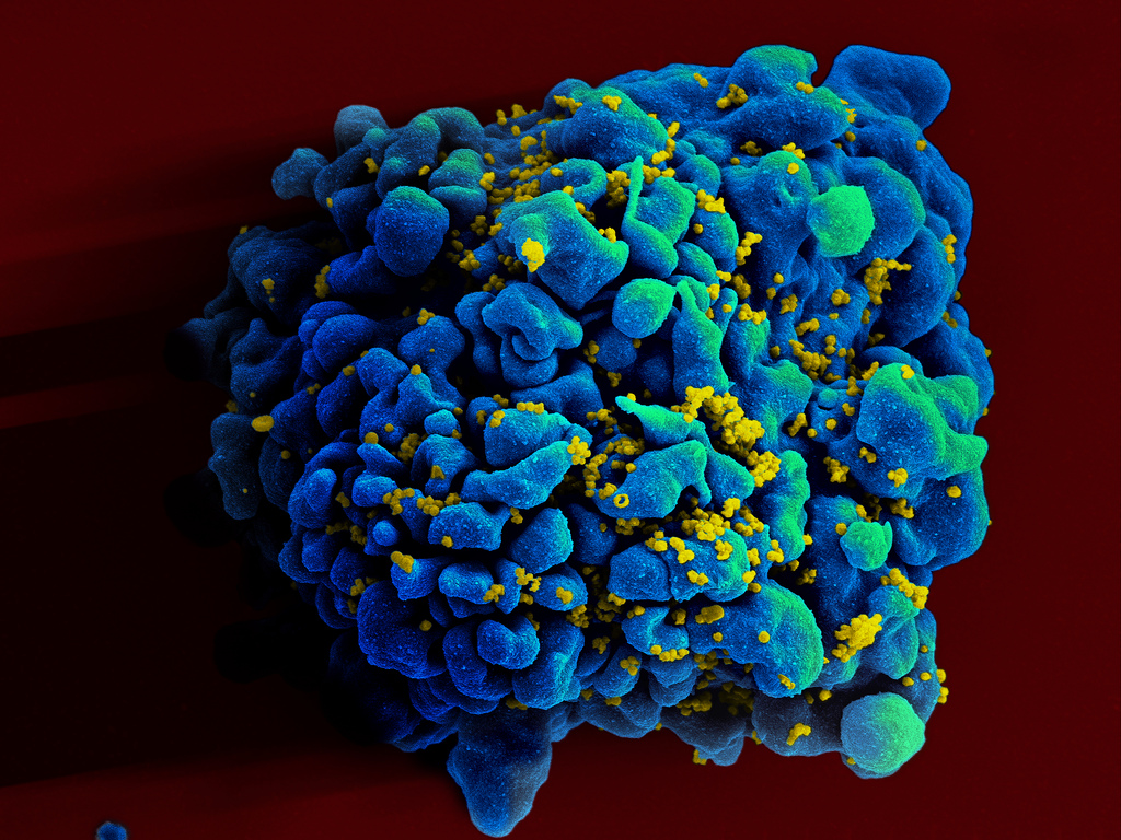 Scanning electromicrograph of an HIV-infected H9 T cell. Credit: NIAID