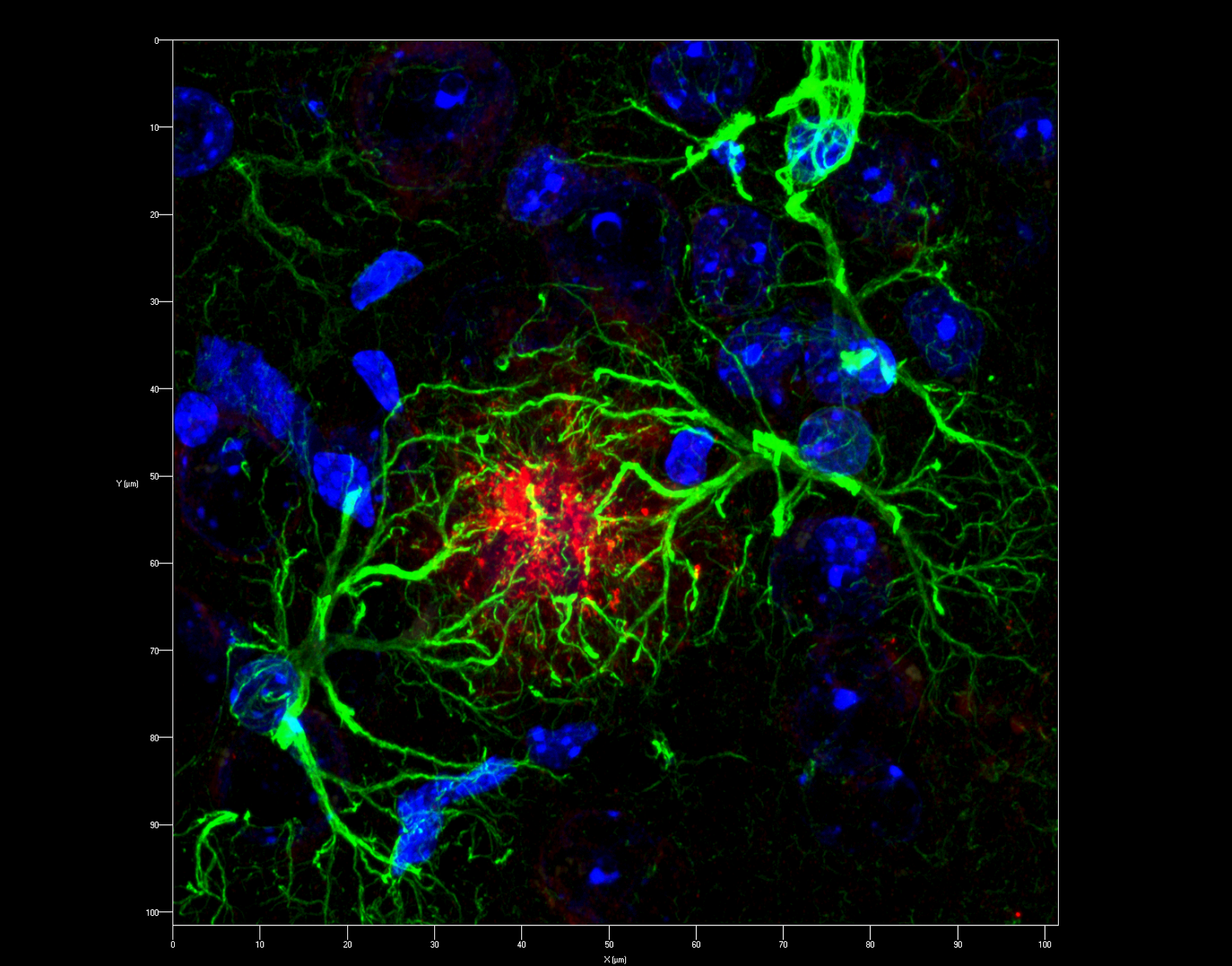 Is infection, or immune response, a contributing factor in neurodegeneration?. Credit: Prof. Jens Pahnke