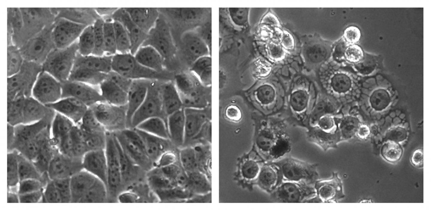 Cancer cells were treated with a control (left) and the overstimulating compound MCB-613 (right). Credit: Lei Wang
