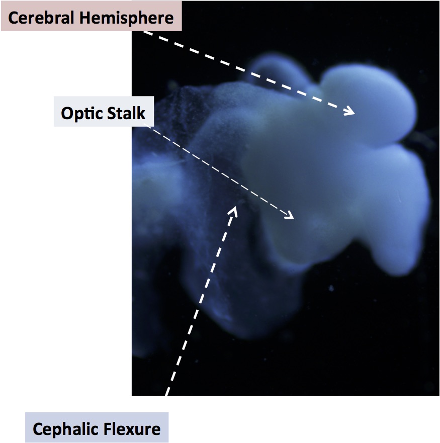 Lab-grown brain is labeled to show identifiable structures: the cerebral hemisphere, the optic stalk and the cephalic flexure, a bend in the mid-brain region, all characteristic of the human fetal brain. Courtesy: The Ohio State University