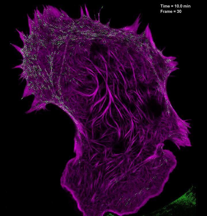 A still image from a video showing the interaction of filamentous actin Credit: Betzig Lab, HHMI/Janelia Research Campus