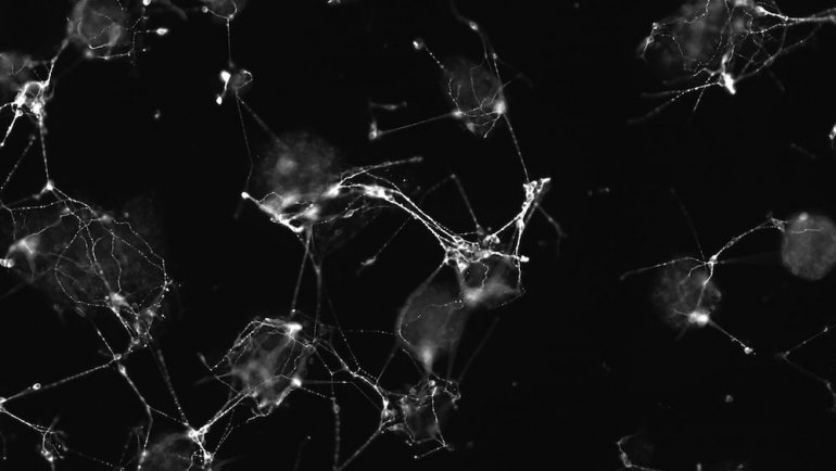 A brain-like network of neural progenitors 96 hours after being stimulated to turn into neurons. Image courtesy of Thomson lab/UCSF
