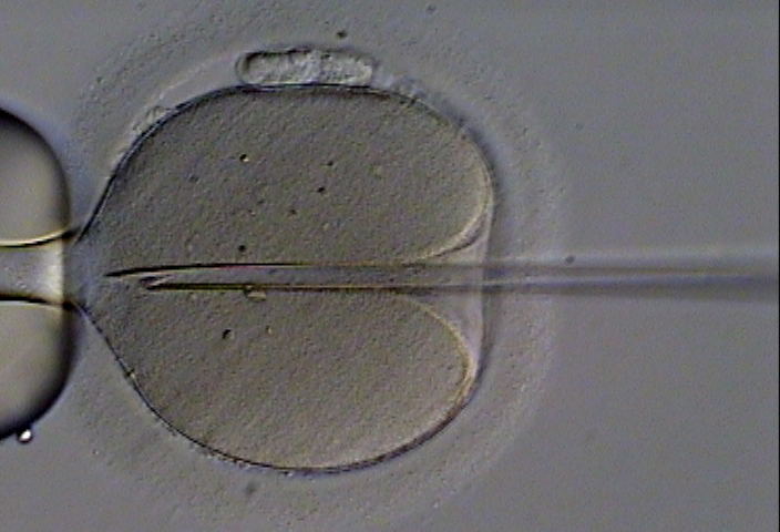 IVF is pricy and often ineffective