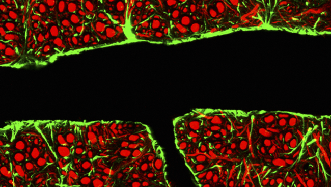 Credit: C.J. Guerin, MRC Toxicology Unit / Science Source.