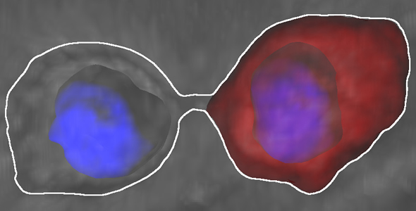  Here you can see the asymmetric sorting of damaged proteins Credit: UZH