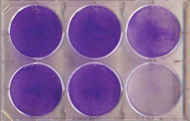 These are different plates of glioblastoma cells. The 1st and 2nd columns from the left show application of an anti-depressant or blood thinner alone. The 3rd column displays that combining the two is far more effective. Credit: Douglas Hanahan.