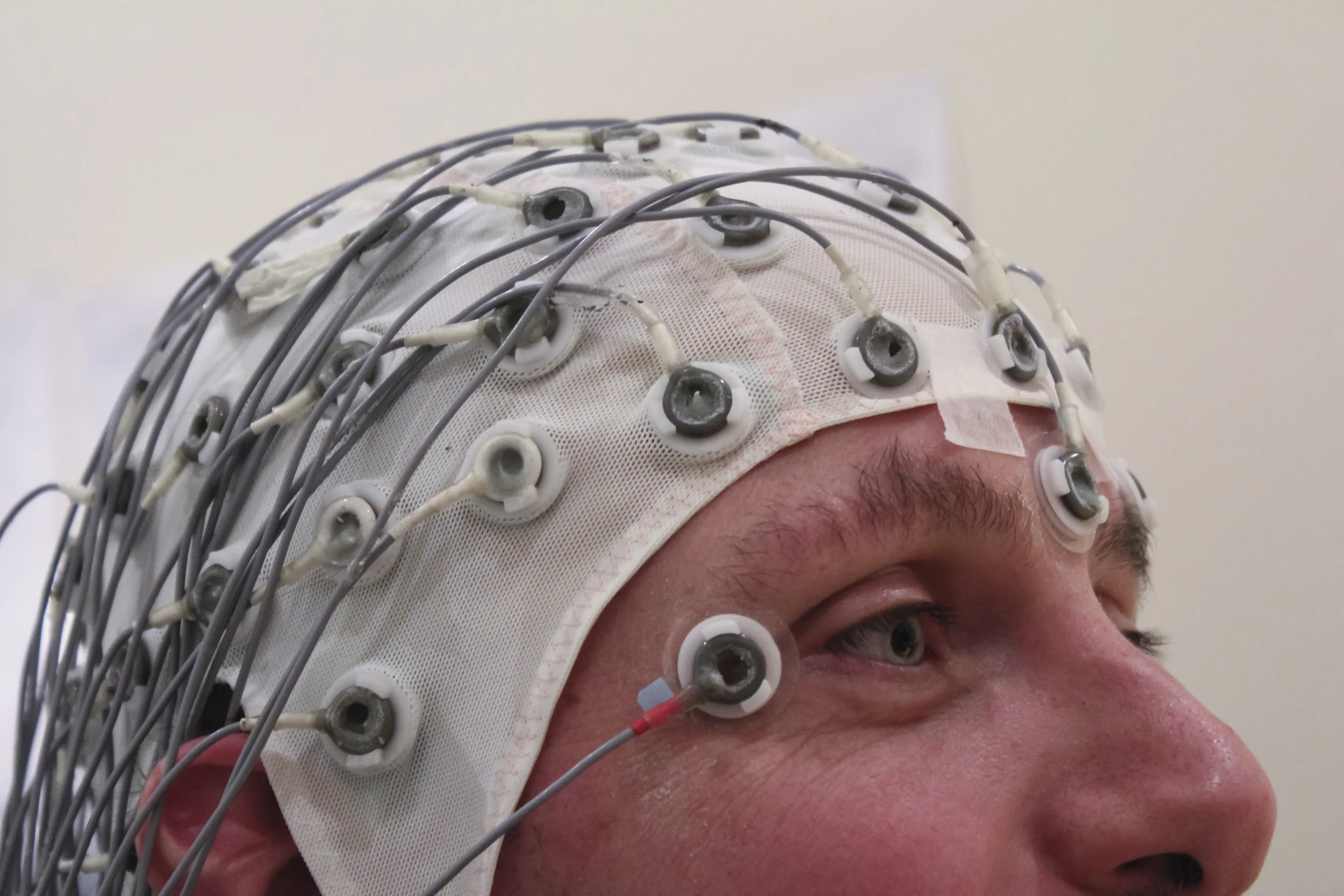 A patient being tested with EEG