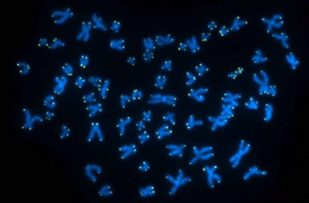 Telomerase extends the caps of your chromosomes called telomeres (shown in green), and enables them to divide without fraying. Credit: Blasco Laboratory