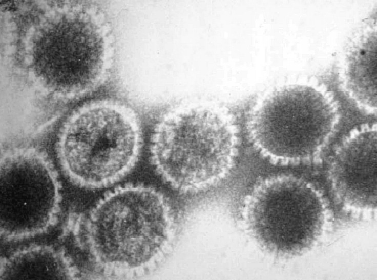 An electron micrograph image of a herpes virus 