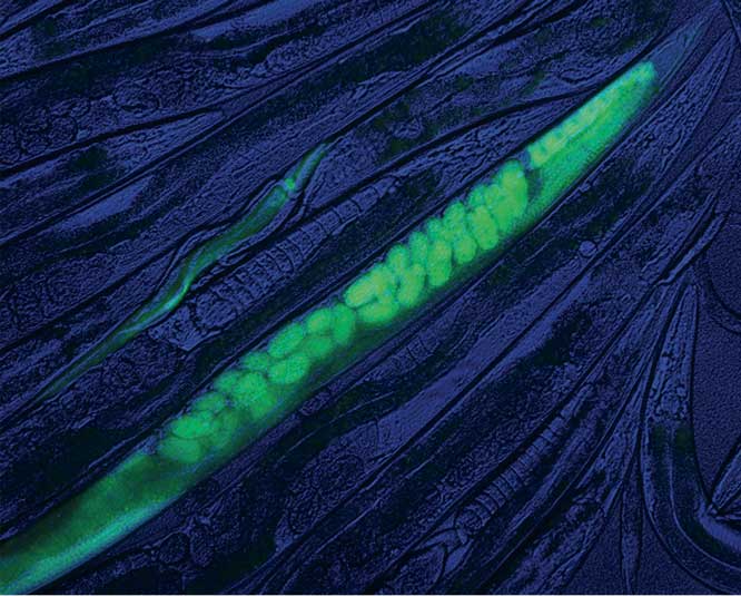 The worm C. elegans expressed green fluorescent protein after editing with CRISPR. Image courtesy of Alexandre Paix.