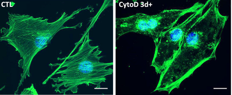 Actin strands are labelled green. After adding cytochalasin D, they break up and collect in the nucleus (right) Credit: UNC School of Medicine