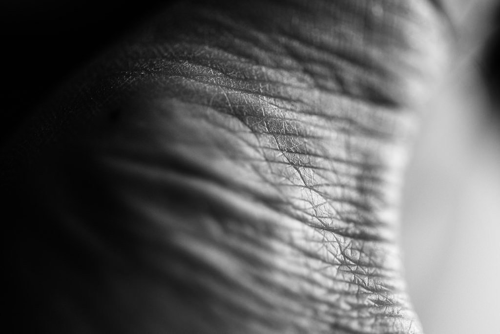 Skin wrinkling isn't just a cosmetic issue Credit: r. nial bradshaw