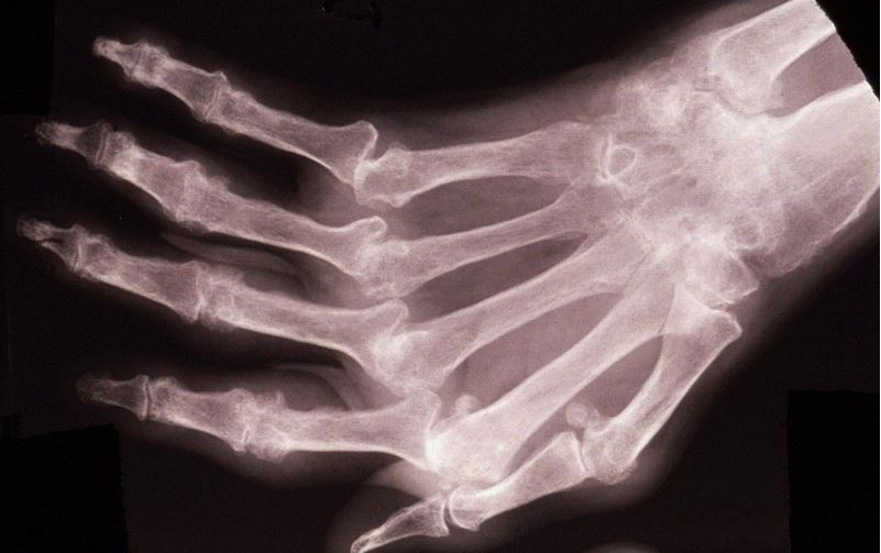Credit: Wellcome Images