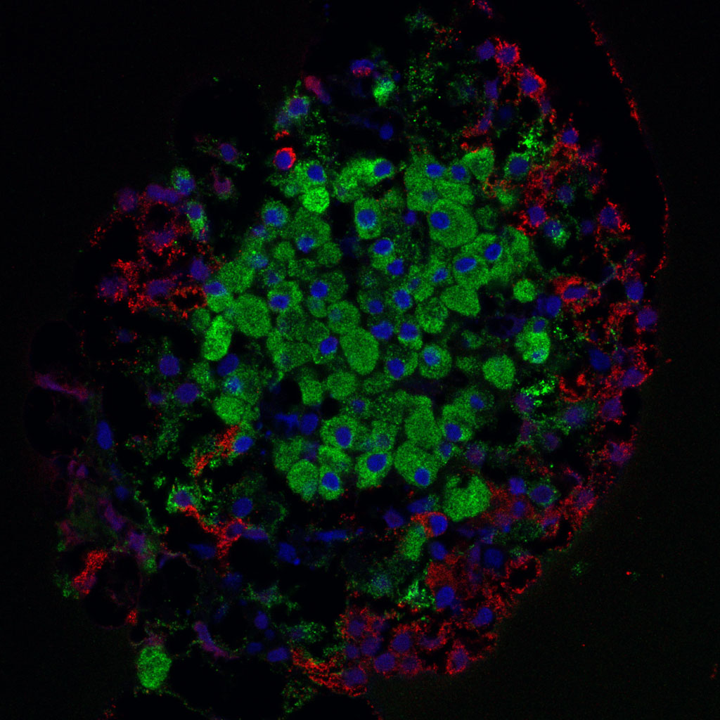 An islet of Langerhans cluster including beta cells, from a rat pancreas