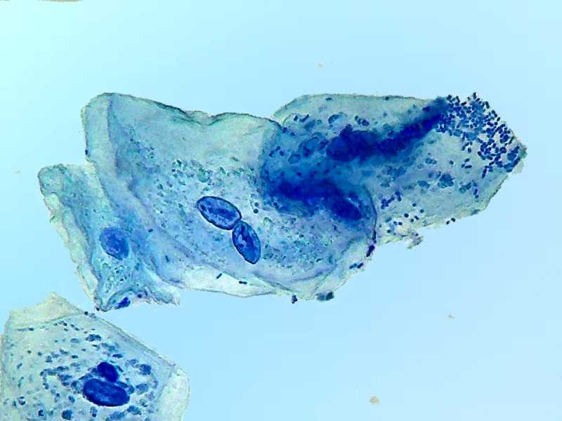 Methylene blue staining of cells 