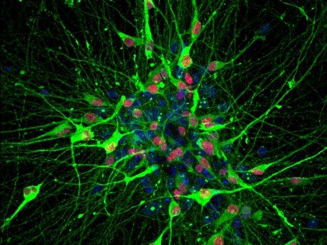 Human serotonin-producing neurons, generated from induced pluripotent stem cells. Credit: Jianfeng Lu and Su-Chun Zhang, University of Wisconsin-Madison