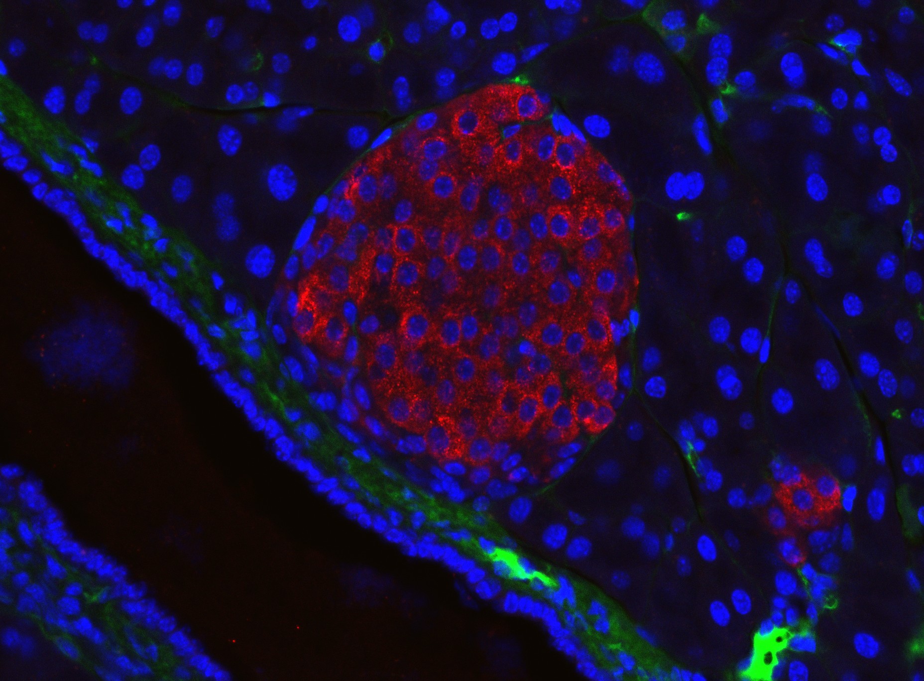 Pancreatic islet Credit: Paul Langerhans Institute Dresden
