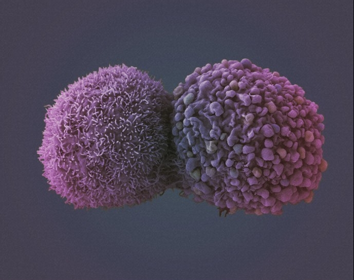 Credit: Wellcome Images