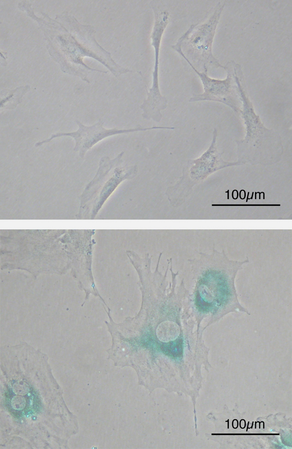 Senescent cells (stained blue) produce inflammatory, pro-oxidant signals