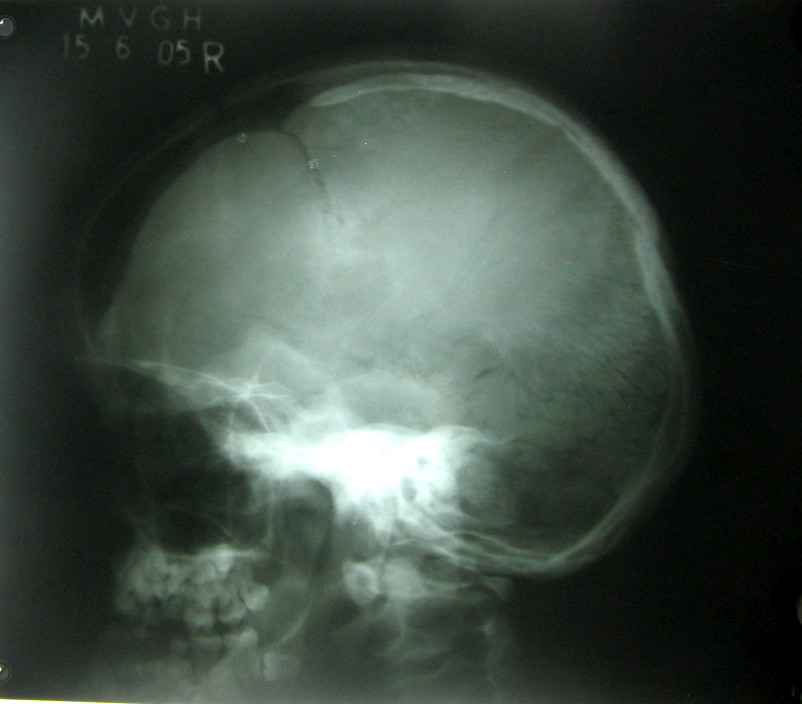 The hope is that stem cells could treat birth defects and craniofacial injury