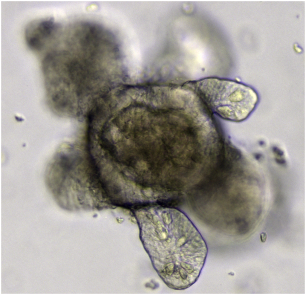 An intestinal 'organoid', or mini organ grown from stem cells Credit: St Johnston D