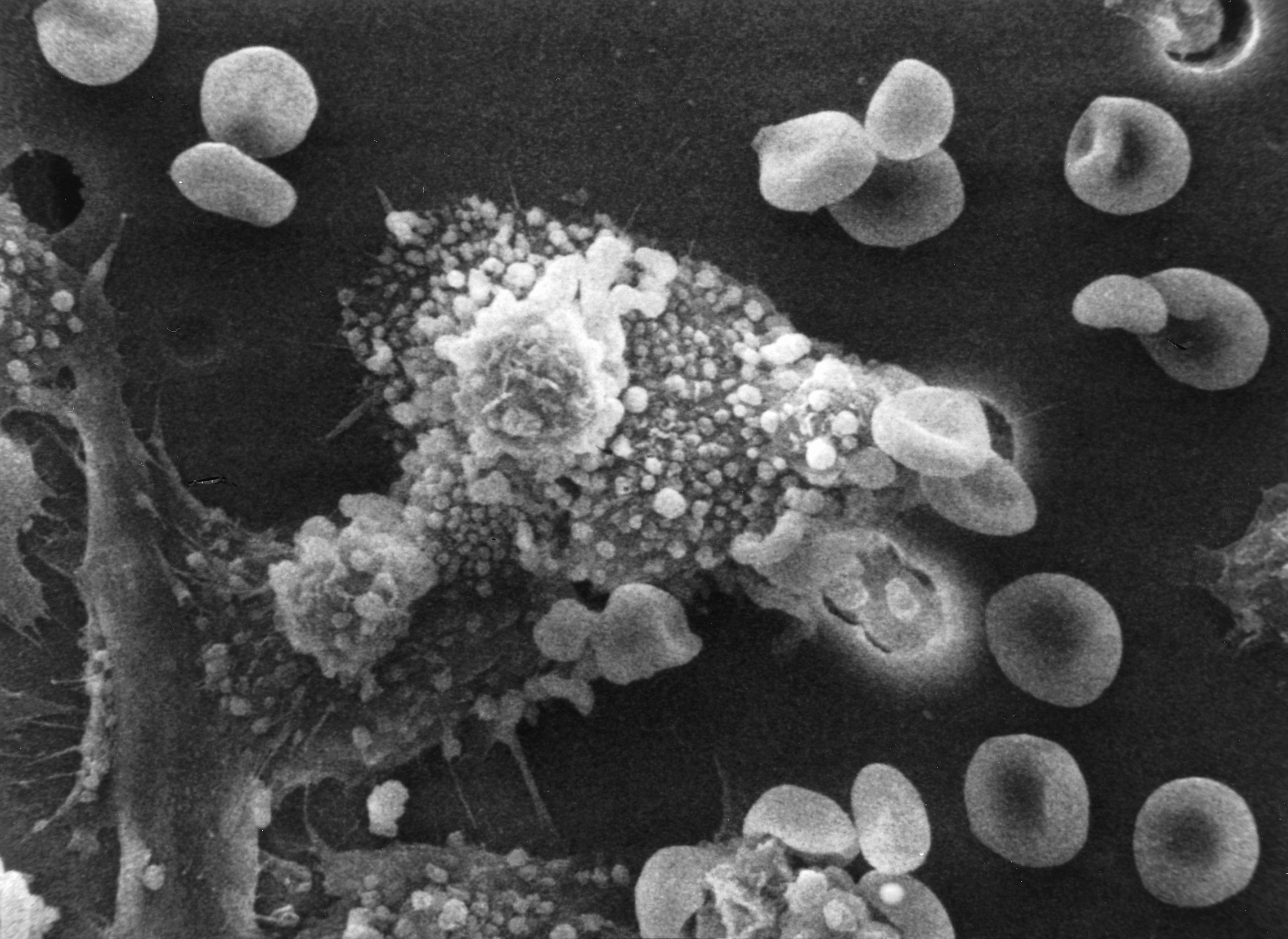Macrophages identifying a cancer cell Credit: National Cancer Institute