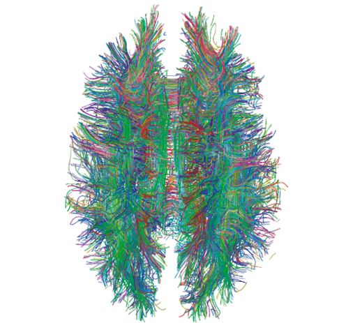 Unravelling the immense complexity of the brain is going to require serious computing power