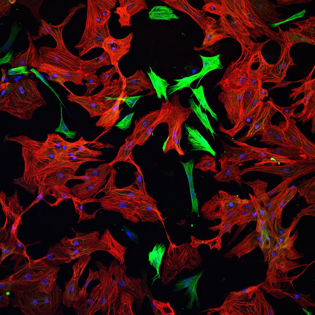 Cardiomyocytes Credit: Arboreus/Flickr