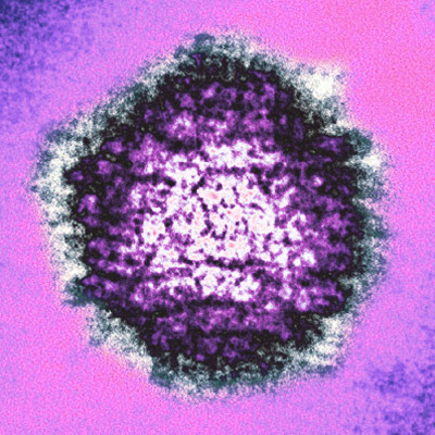 There is some evidence that the herpes simplex virus may have an influence on Alzheimer's disease