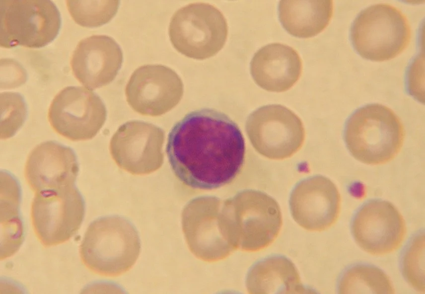 Caloric restriction could have negative effects on lymphocyte production 