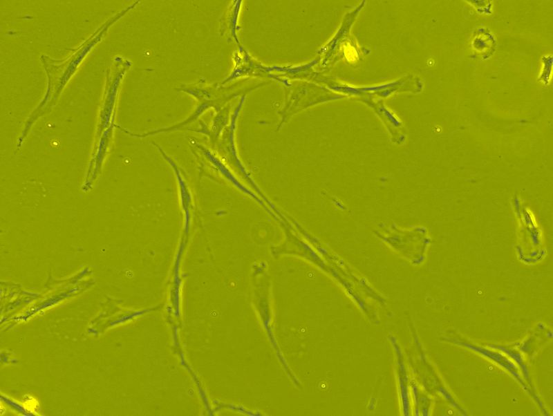 Mesenchymal stem cells can become bone, cartilage, muscle and fat cell types 