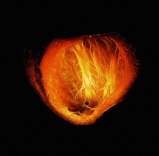 The left ventrice of a mouse heart. Credit Laurence Jackson, Centre for Advanced Biomedical Imaging, Wellcome Images
