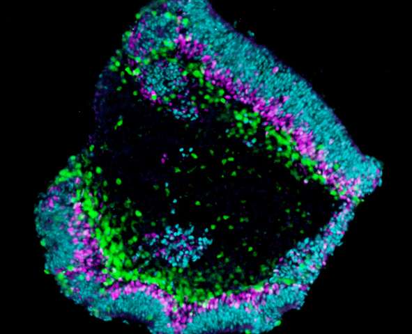 A crosssection of the retina organoid Credit: Manuela Völkner and Mike O. Karl