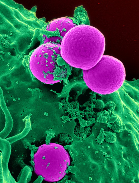 So far only white blood cell telomere lengths have been measured. We'll have to wait to learn the effect the rest of the body 