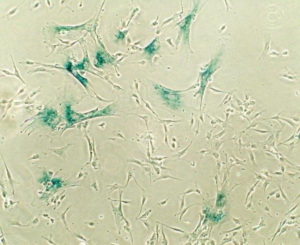 Senescent cells have a characteristic appearance (blue) 