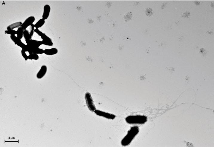 Amyloid fibrils capturing Candida albicans. Credit: D.K.V. Kumar et al. / Science Translational Medicine (2016)